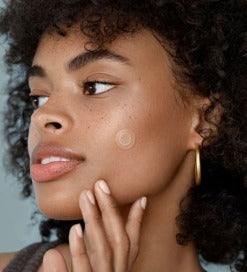 Parche Acne Pimple Master